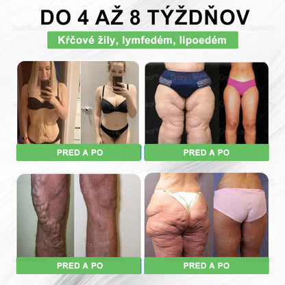 BuildLeaf® GLP-1 8-v-1 Fit & Vital Perorálny Roztok✅ (Len raz denne, viditeľné zmeny už za 7 dní) Pre obezitu, kardiovaskulárne ochorenia, cukrovku, spánkové apnoe, zdravie čriev, problémy s kĺbmi a ďalšie